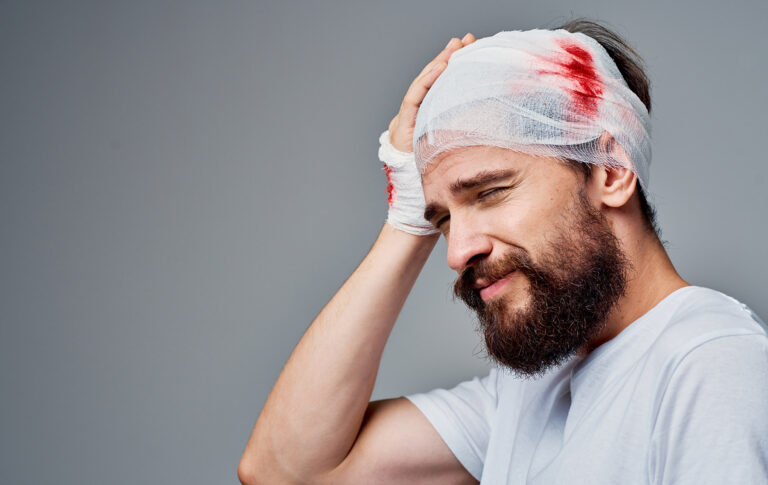 Head injury compensation claims in Bolton